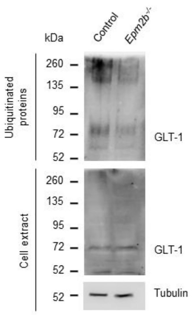 Decreased ubiquitination of GLT-1 in LD primary astrocytes.jpg